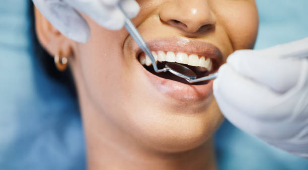 Best Emergency Gum Treatment in Riverton, NJ